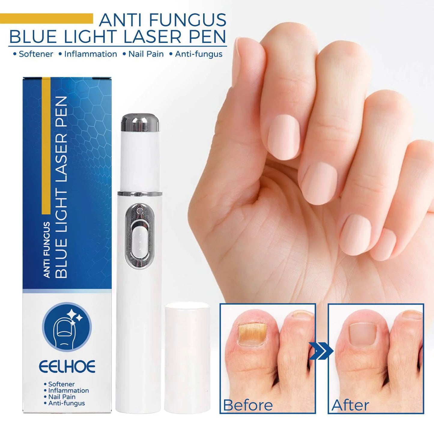 TG Nail Blue Light Laser Treatment Pen