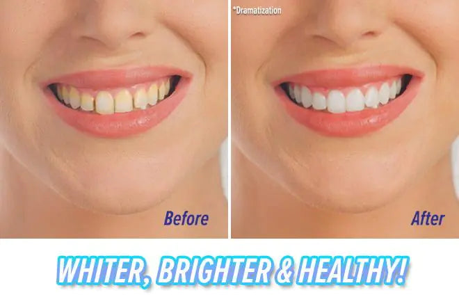 Teeth Cleaning and Polishing Tooth Device