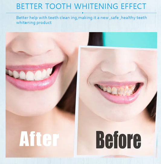 Teeth Whitening Pen- Smile Brighter