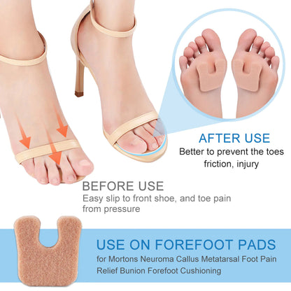 Anti-Abrasion Forefoot Pads for Pain Relief