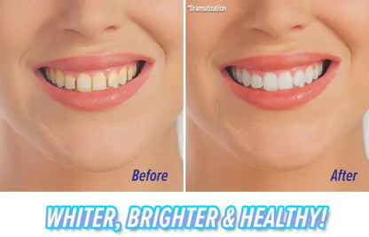 Teeth Cleaning and Polishing Tooth Device