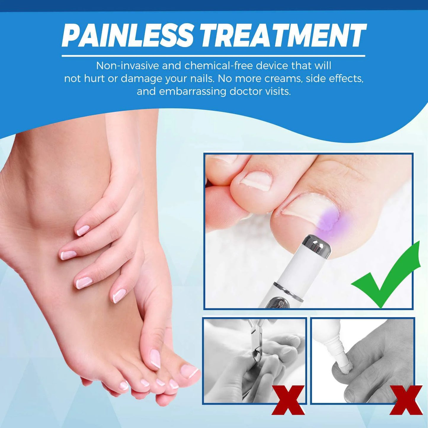 TG Nail Blue Light Laser Treatment Pen