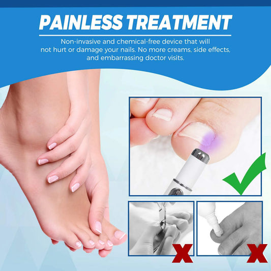 TG Nail Blue Light Laser Treatment Pen
